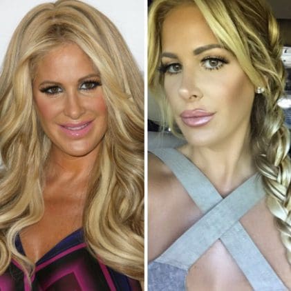 Kim Zolciak Biermann Addresses Plastic Surgery Rumors Gets Candid About Which Procedures She S Had Done The Real Housewives News Dirt Gossip Check out our kim zolciak biermann selection for the very best in unique or custom, handmade pieces from our shops. kim zolciak biermann addresses plastic
