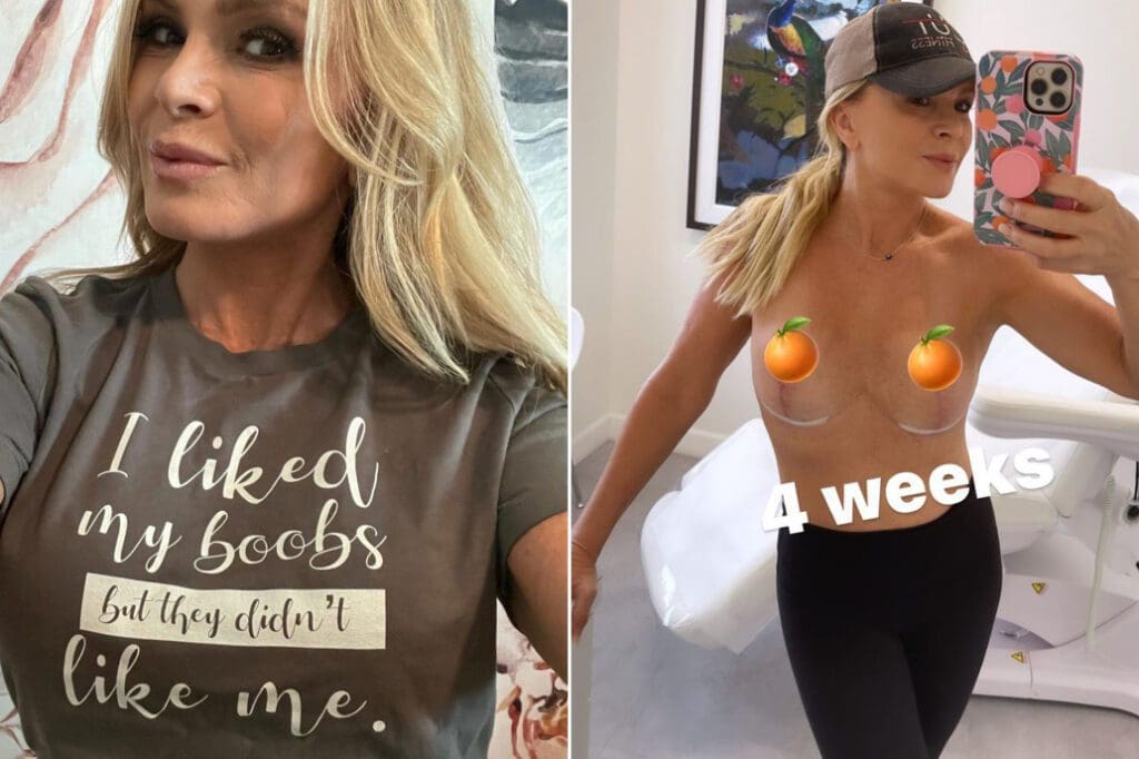 Tamra Judge Poses Topless One Month After Breast Implant Removal