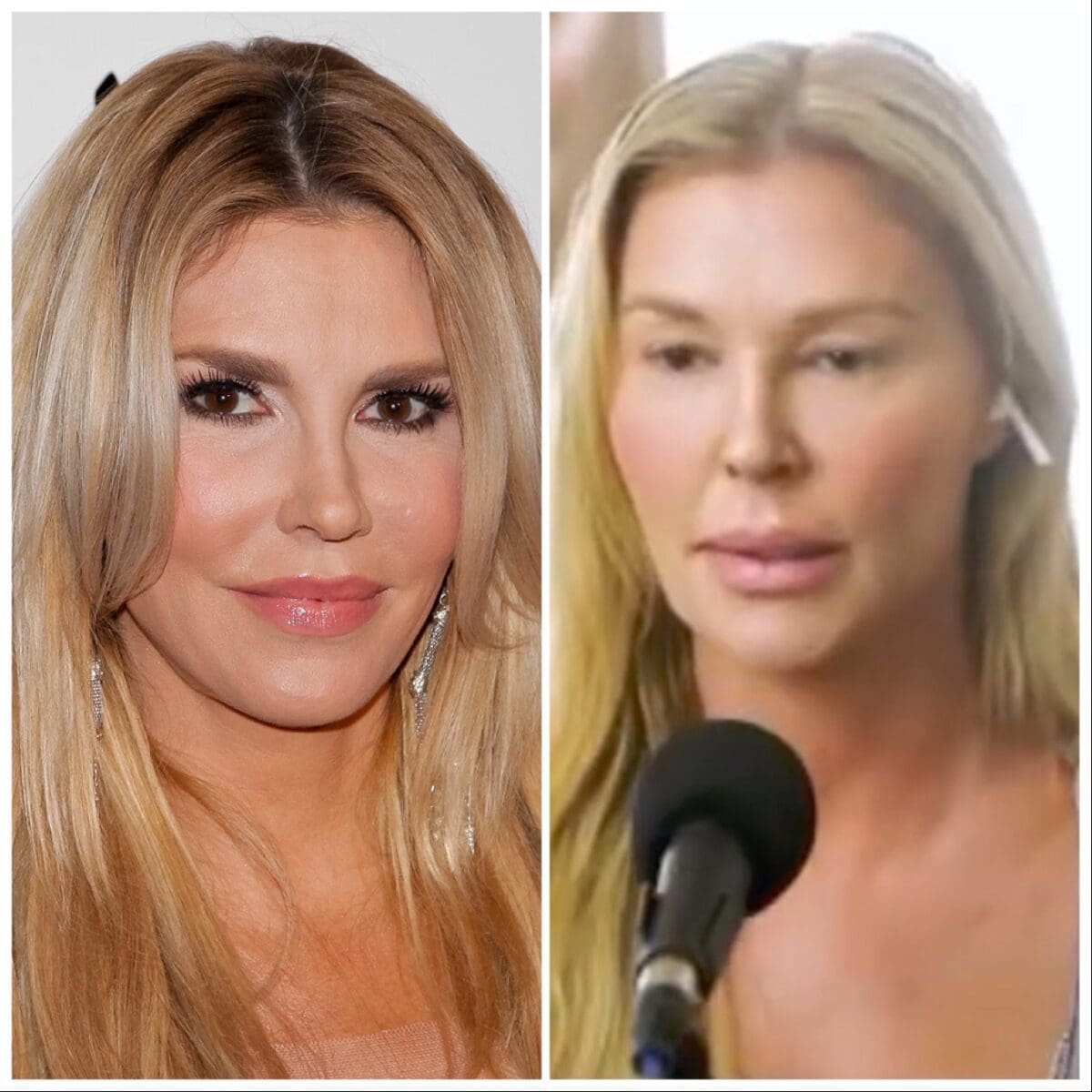onduidelijk camouflage Oude man Brandi Glanville Fires Back at Trolls Accusing her of 'Bad Plastic Surgery'