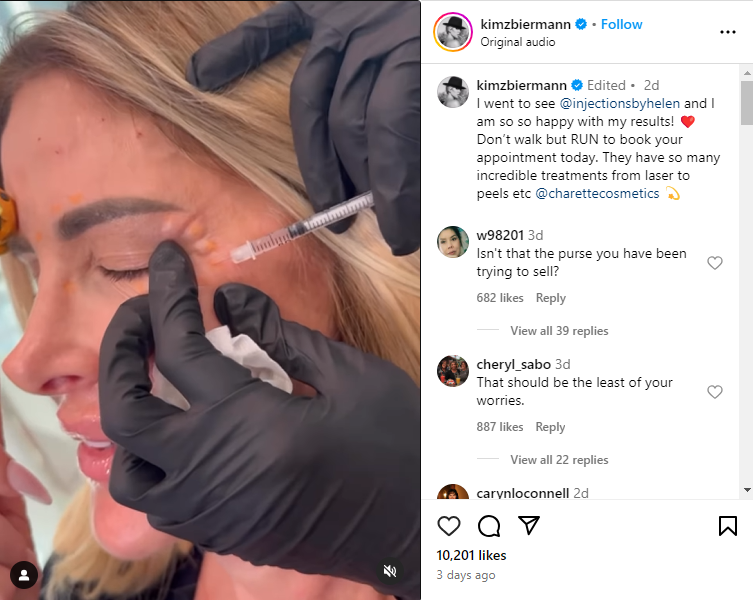 Kim Zolciak gets roasted by fans over filler and botox post on Instagram. 